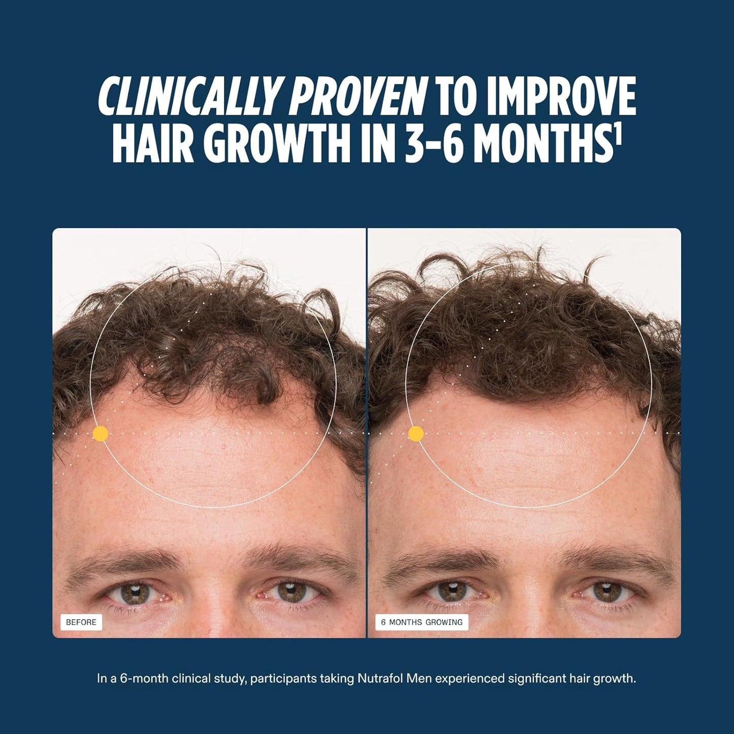 Nutrafol* Men Hair Growth Supplements Ages 18-49 for Thinning Hair Clinically Tested for Visibly Thicker Hair and Scalp Coverage Dermatologist Recommended