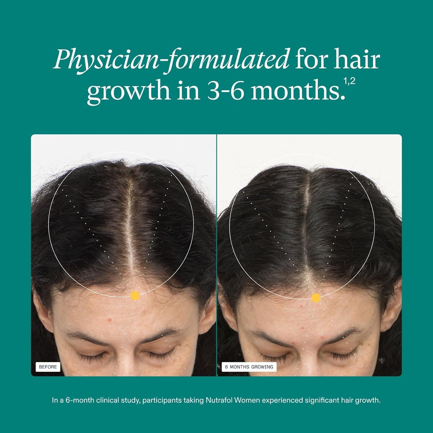 Nutrafol* Women's Hair Growth Supplements, Clinically Tested for Visibly Thicker and Stronger Hair, Dermatologist Recommended
